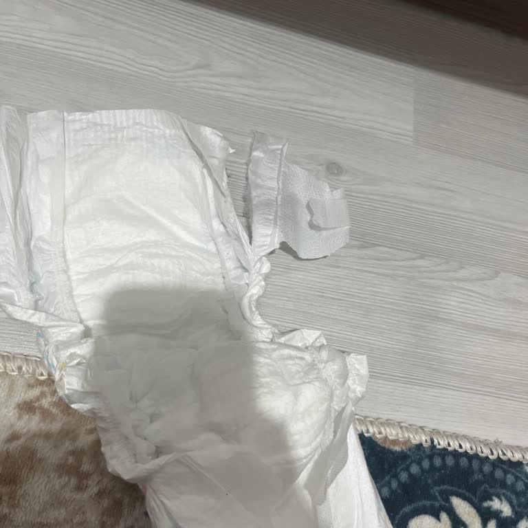 Molfix Bebek Bezinde Sızdırma Ve Bant Kopması Sorunu