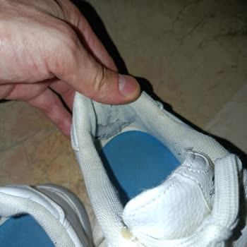 Slazenger Ayakkabısının Hızlı Yıpranması Ve Değişim Talebi