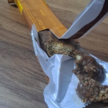 Ülker Albeni Ürünün İçinde Saç Teli Bulunması Ve Hijyen Şikayeti