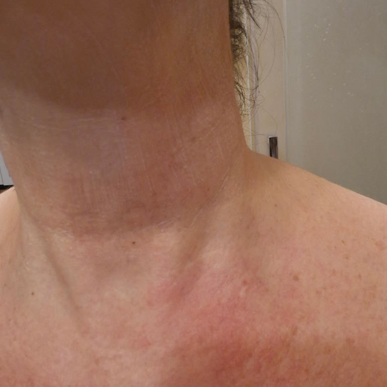 Rossmann'dan Organik Losyon Ve Şampuanın Ciltte Kaşıntı Ve Saçta Sertleşme Oluşturması