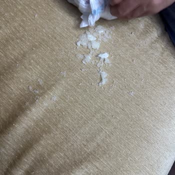 Molfix Bebek Bezinde Jel Sızıntısı Ve Cilt Tahrişi