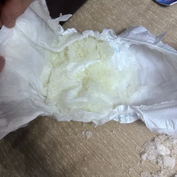 Molfix Bebek Bezinde Jel Sızıntısı Ve Cilt Tahrişi