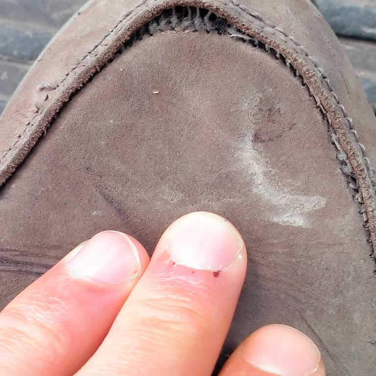 FLO Mağazasında Alınan Ayakkabının Dikiş Sorunu Ve İki Yıl Garanti İhlali