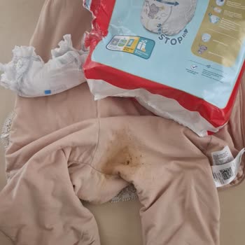 Prima Külot Bezinde Sızıntı Ve Müşteri Hizmetlerine Ulaşılamama