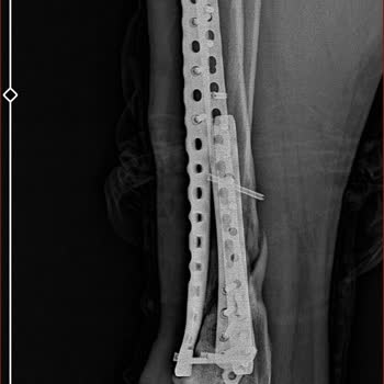 Yüzde 24 Engel Oranı Gerçek Hasarı Yansıtmaz Adil Yeniden Değerlendirme Talebi