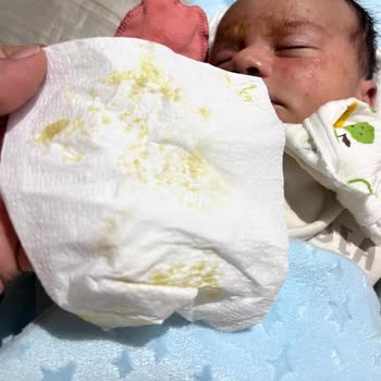 Yenidoğan Bebekte Mustela Şampuanı Şiddetli Konak Ve Şişlik Yarattı