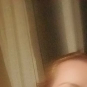 Saç Boyasında Yanlış Numara Nedenli Turuncu Renk Ve Saç Zarar Görmesi