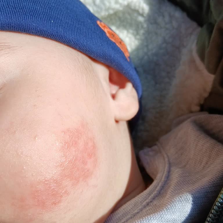 Randevu Saatine Uymayan Doktor Ve Yanlış Yönlendirme Nedeniyle Güven Kaybı