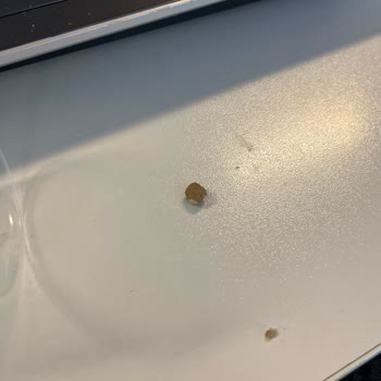 İç Ay Çekirdeğinde Sert Yabancı Madde Diş Kırılmasına Yol Açtı