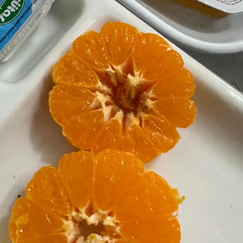 Medicana Sağlık Grubu Gereksiz Uzun Hastanede Kalış, Endoskopi Gecikmesi ve Ticari Öncelik