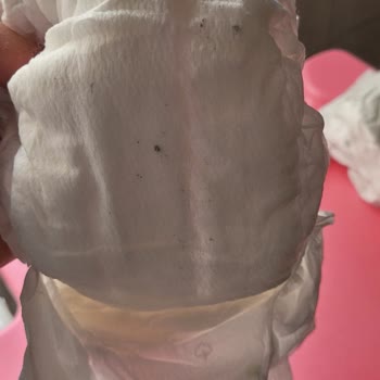 Siyah Lekeli Bebek Bezinde Hijyen Endişesi Ve İade Talebi