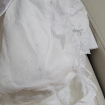 Siyah Lekeli Bebek Bezinde Hijyen Endişesi Ve İade Talebi