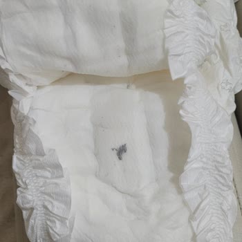 Siyah Lekeli Bebek Bezinde Hijyen Endişesi Ve İade Talebi