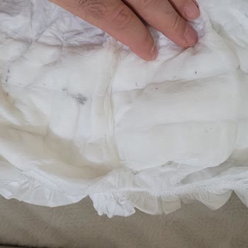 Siyah Lekeli Bebek Bezinde Hijyen Endişesi Ve İade Talebi