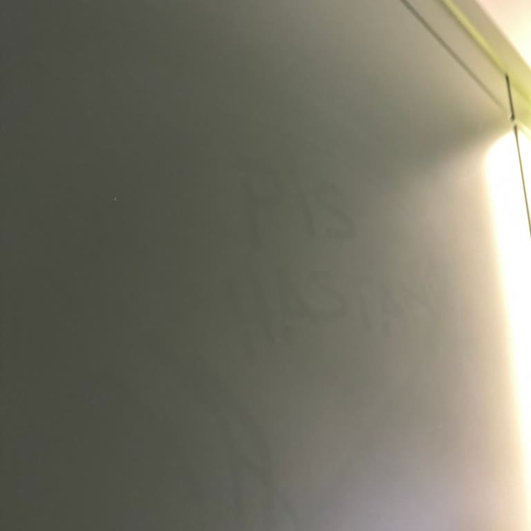 İzin Almadan 25 Bin TL Lazer Ücreti Talebi Ve Hijyenik Olmayan Hastane Hizmeti