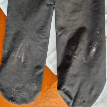 İlk Kullanımda Deforme Olan Termal Çorapta İade Reddi