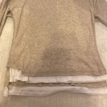 Zara Ürün Etiketi Hatası Ve İade Reddi: Yeni Ürün Gönderilmiyor