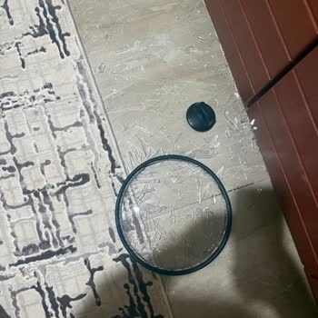 Tencere Kapağının Camı Patladı, Ayak Kesildi Ve Mağduriyetim Giderilmedi