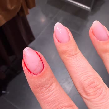 Yolo Beauty Studio Jel Güçlendirme İşleminde Şiddetli Kanama Ve Tırnak Kökü Hasarı