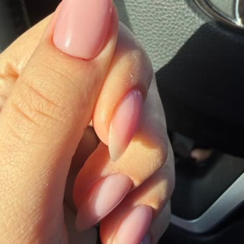 Yolo Beauty Studio Jel Güçlendirme İşleminde Şiddetli Kanama Ve Tırnak Kökü Hasarı