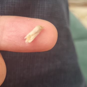 Şenpiliç Doy Farm Piliç Cordon Blue Üründe Keskin Kemik Parçası