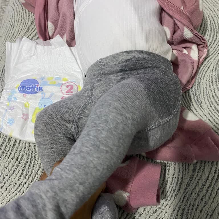 Molfix 2 Numara Bebek Bezinde Bel Sızıntısı Sürekli Alt Değiştirme Sorunu
