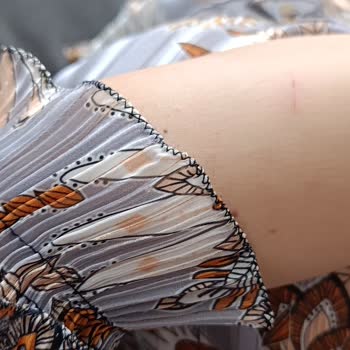 Kısa Kollu Elbise İlanı Yanıltıyor, İade Reddi Ve Destek Yok