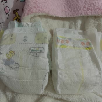 Prima Bebek Bezlerinde Sızdırma Ve Pişik Sorunu