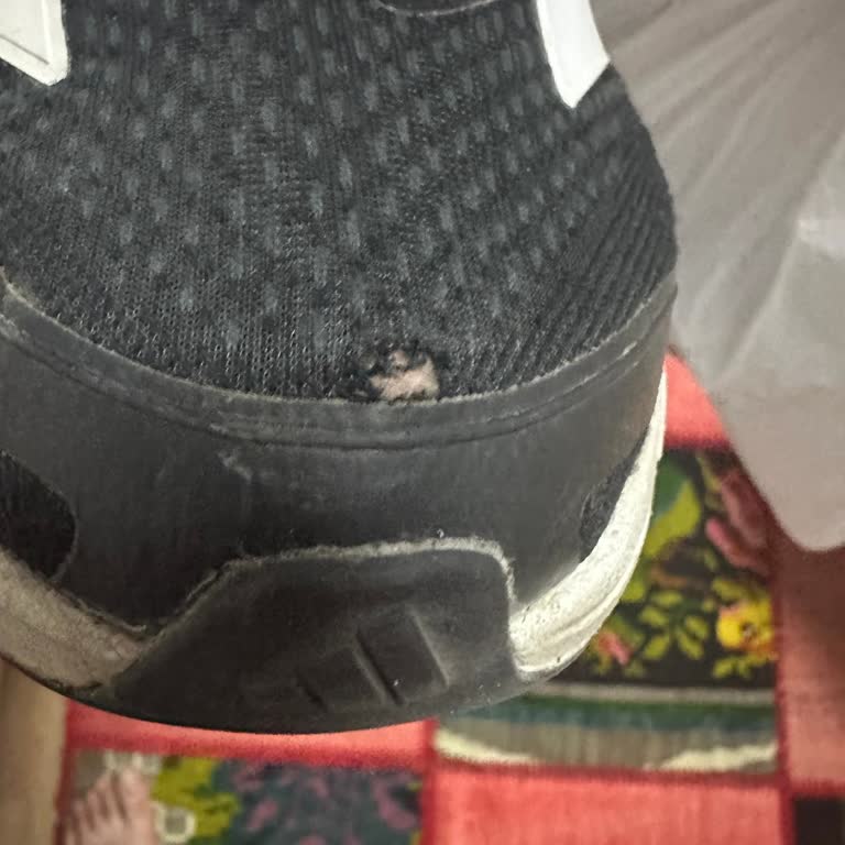 Adidas Ayakkabıda Erken Yırtılma Ve Mağaza Reddi