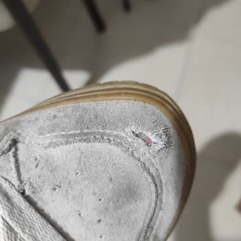 Vans Ayakkabısının Bir Ayda Tabanı Yarıldı, Üstü Yırtıldı Ve Mağaza Cevap Vermedi