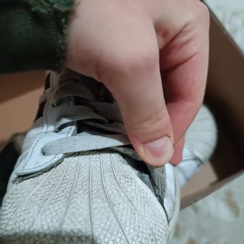 Adidas Ayakkabısındaki Açılma Sorunu Garanti İncelemesinde Reddedildi