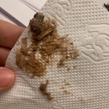 Macro Center’da Algida Dondurmada Tahta Parçası Bulundu