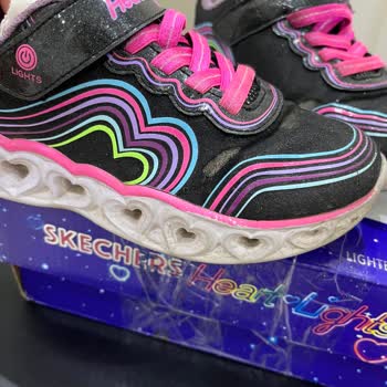 Skechers Çocuk Ayakkabısında Deri Soyulması Ve Haksız Red
