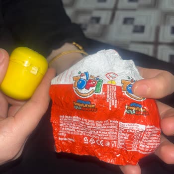 Sürpriz Yumurtada Kıl Ve Hijyen Sorunu