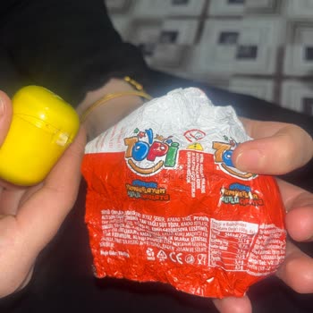 Sürpriz Yumurtada Kıl Ve Hijyen Sorunu