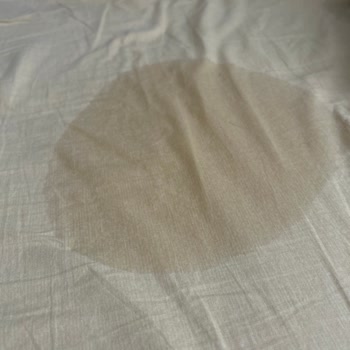 Prima Bezlerinin Sızdırması Çocuğumu Sırılsıklam Bırakıyor