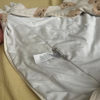 Prima Bezlerinin Sızdırması Çocuğumu Sırılsıklam Bırakıyor