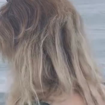 Saçım Koptu Ve Yanarak Zarar Gördüm, Kuaför Dikkatsizliğini Gözardı Ediyor