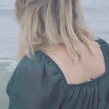 Saçım Koptu Ve Yanarak Zarar Gördüm, Kuaför Dikkatsizliğini Gözardı Ediyor