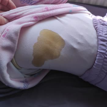 Fresh Life Bezlerde Ciddi Bir Sızıntı Problemi Yaşamaya Başladım