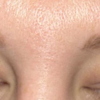 Refika Güzellik | Florya Ücretimin Karşılığını Alamadım, Defalarca Oyalandım