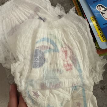 Molfix Bebek Bezlerinde Sızdırma Ve Yan Yırtıklar: Kalite Sorunu