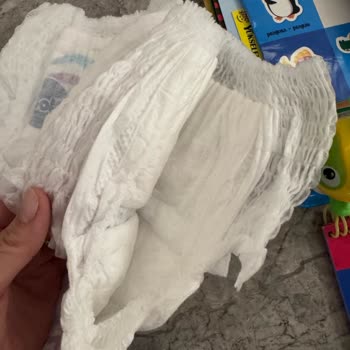 Molfix Bebek Bezlerinde Sızdırma Ve Yan Yırtıklar: Kalite Sorunu