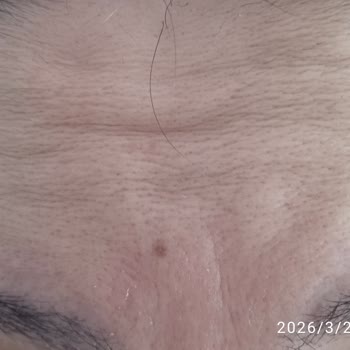 Maya Eczanesi Ankara Caudalie Kremi Yüzde Kırışıklık Yaratması Ve İade Reddi