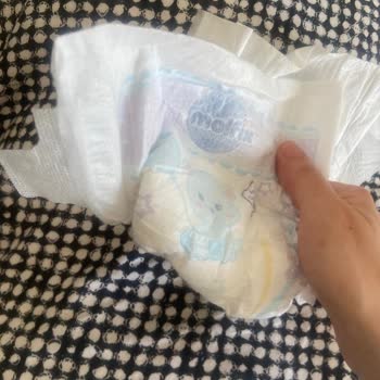 Molfix Bebek Bezlerinde Yan Bantların Çabuk Kopması