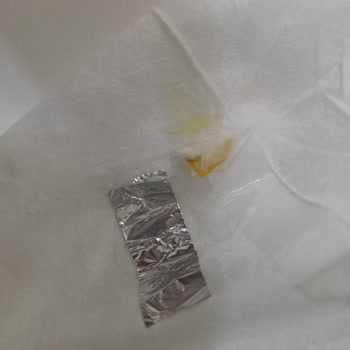 Solo Yüzey Temizleme Mendilinde Yabancı Cisim Hijyen Endişesi Yaratıyor