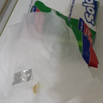 Solo Yüzey Temizleme Mendilinde Yabancı Cisim Hijyen Endişesi Yaratıyor