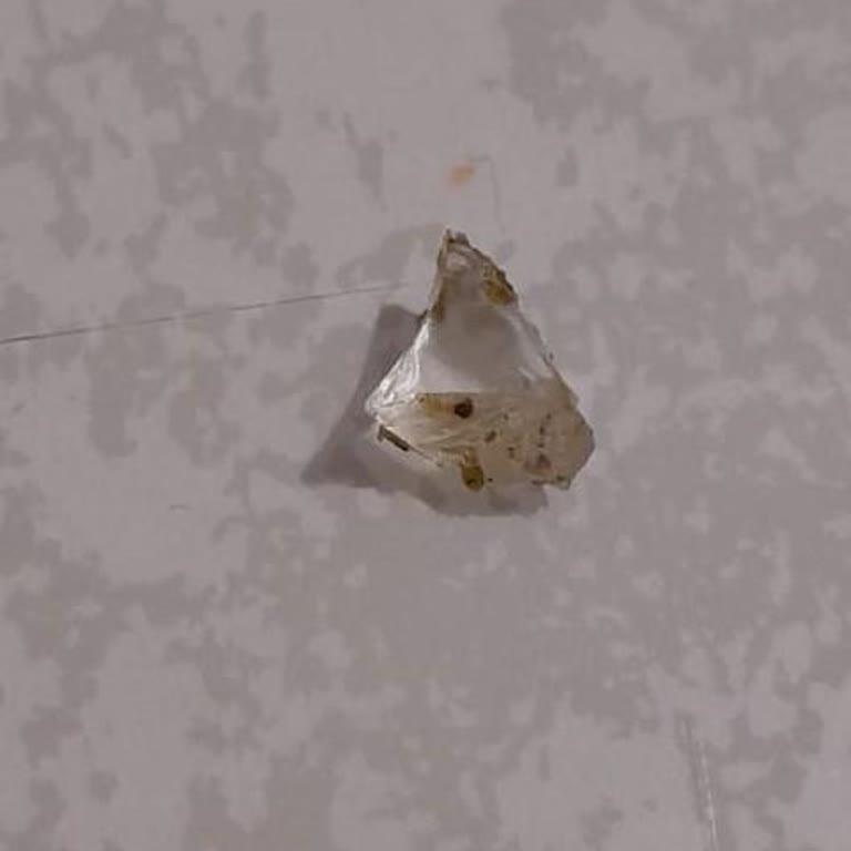 Cam Ve Taş İçeren Antep Fıstığı, Baklavamıza Sağlık Riski Ve Zarar Getirdi