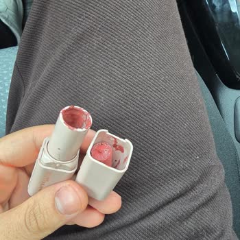 Watsons Şubeler Arasında İade Kodu Kullanımında Tutarsızlık Ve Açıklama Talebi