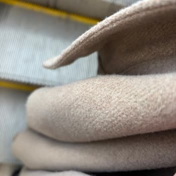 Koton Erkek Montunda Aşırı Tiftiklenme Ve Ücret İadesi Talebi